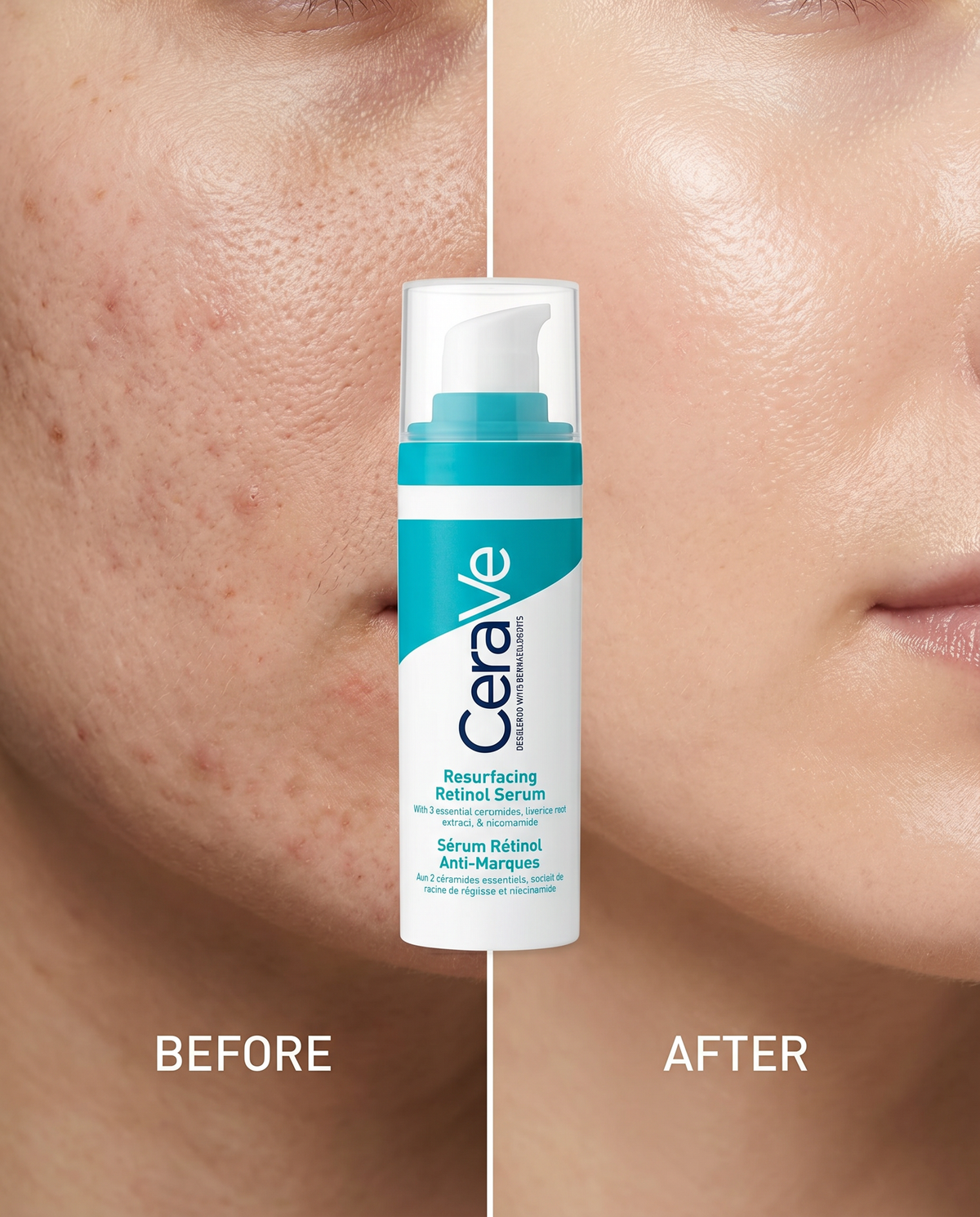 CeraVe Sérum Retinol Anti-Manchas 30ml | Piel Más Luminosa y Uniforme