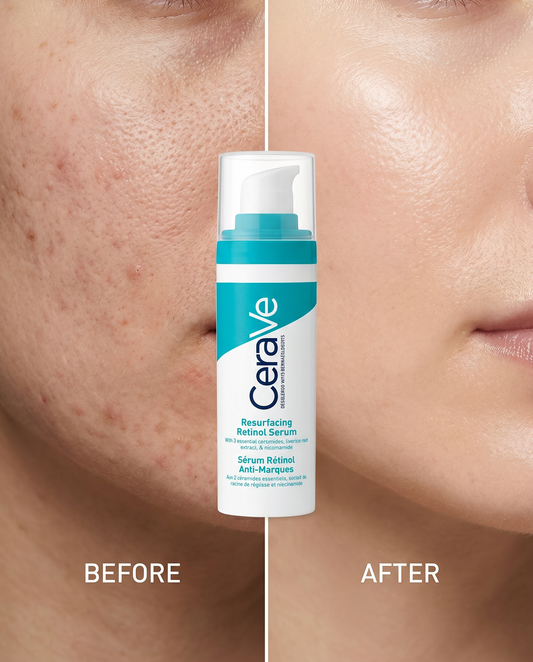 CeraVe Sérum Retinol Anti-Manchas 30ml | Piel Más Luminosa y Uniforme